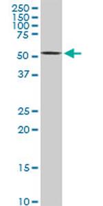 AKT2 Antibody in Western Blot (WB)