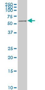 AKT2 Antibody in Western Blot (WB)