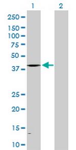 ALAD Antibody in Western Blot (WB)