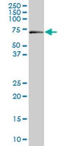 ALAS1 Antibody in Western Blot (WB)