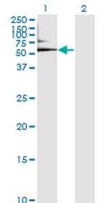 ALB Antibody in Western Blot (WB)