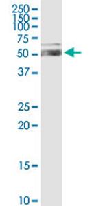 ALDH1A1 Antibody in Western Blot (WB)