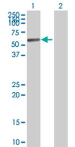 ALDH1A1 Antibody in Western Blot (WB)