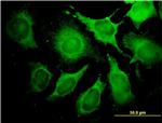 ALDOA Antibody in Immunocytochemistry (ICC/IF)