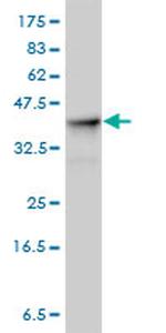 ALDOA Antibody in Western Blot (WB)