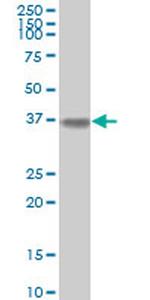 ALDOA Antibody in Western Blot (WB)