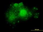 ALDOA Antibody in Immunocytochemistry (ICC/IF)