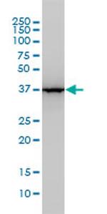 ALDOA Antibody in Western Blot (WB)