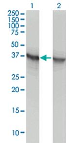 ALDOA Antibody in Western Blot (WB)