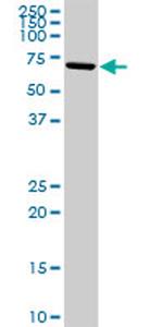 ALOX15 Antibody in Western Blot (WB)