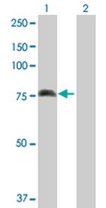 ALOX15 Antibody in Western Blot (WB)