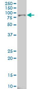 ALOX15 Antibody in Western Blot (WB)