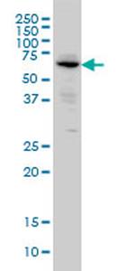 ALPI Antibody in Western Blot (WB)