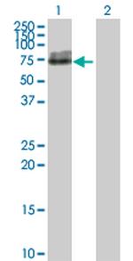 ALPL Antibody in Western Blot (WB)