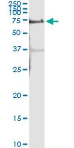 ALPPL2 Antibody in Immunoprecipitation (IP)