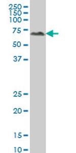 ALPPL2 Antibody in Western Blot (WB)