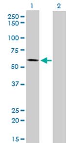 ALPPL2 Antibody in Western Blot (WB)