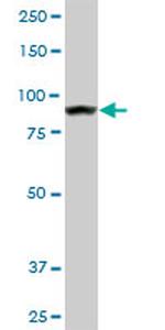 AMPD2 Antibody in Western Blot (WB)