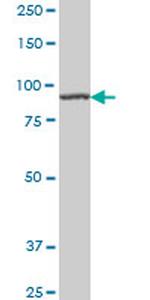 AMPD2 Antibody in Western Blot (WB)