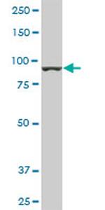 AMPD2 Antibody in Western Blot (WB)