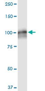 AMPD2 Antibody in Western Blot (WB)