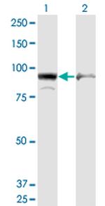 AMPD2 Antibody in Western Blot (WB)