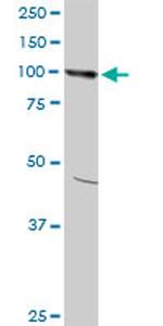 AMPD2 Antibody in Western Blot (WB)