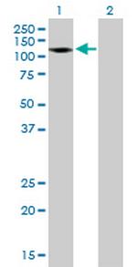 AMPH Antibody in Western Blot (WB)