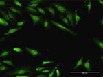 BIN1 Antibody in Immunocytochemistry (ICC/IF)