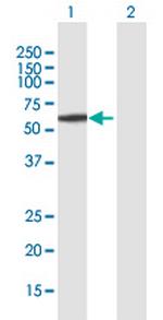 AMY2A Antibody in Western Blot (WB)