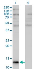 ANG Antibody in Western Blot (WB)