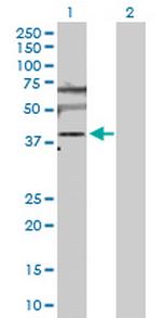 SLC25A6 Antibody in Western Blot (WB)