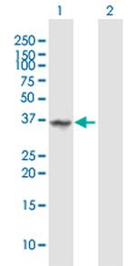 ANXA1 Antibody in Western Blot (WB)