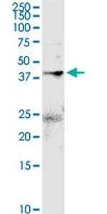 ANXA2 Antibody in Western Blot (WB)