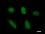 ANXA5 Antibody in Immunocytochemistry (ICC/IF)