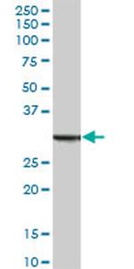 ANXA5 Antibody in Western Blot (WB)