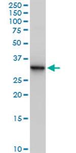 ANXA5 Antibody in Western Blot (WB)