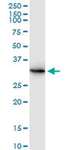 ANXA5 Antibody in Western Blot (WB)