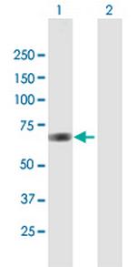 ANXA6 Antibody in Western Blot (WB)