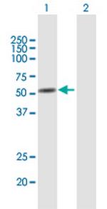 ANXA11 Antibody in Western Blot (WB)