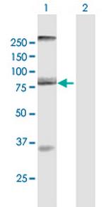 AOC2 Antibody in Western Blot (WB)