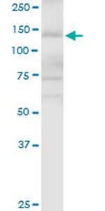 APAF1 Antibody in Western Blot (WB)