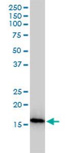 NUDT2 Antibody in Western Blot (WB)