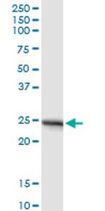 APOA1 Antibody in Western Blot (WB)