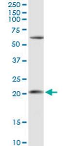 APRT Antibody in Western Blot (WB)