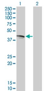 FAS Antibody in Western Blot (WB)