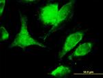 FASLG Antibody in Immunocytochemistry (ICC/IF)