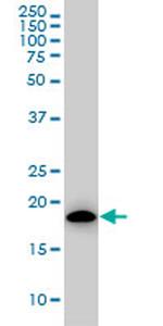 ARF5 Antibody in Western Blot (WB)