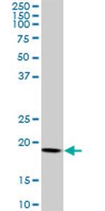 ARF5 Antibody in Western Blot (WB)