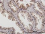 ARG2 Antibody in Immunohistochemistry (Paraffin) (IHC (P))